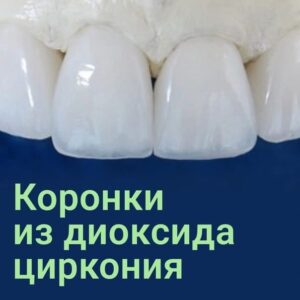 Протезирование циркониевыми коронками в СПб — стоматология «Премьера» ☎ +7 (812) 305-90-18