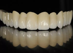 Зубные коронки на циркониевом каркасе — стоматология «Премьера» ☎ +7 (812) 305-90-18