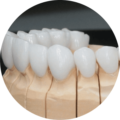Цельнокерамические коронки на зубы в СПб — стоматология «Премьера» ☎ +7 (812) 305-90-18