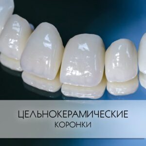 Керамические зубные коронки в СПб — стоматология «Премьера» ☎ +7 (812) 305-90-18