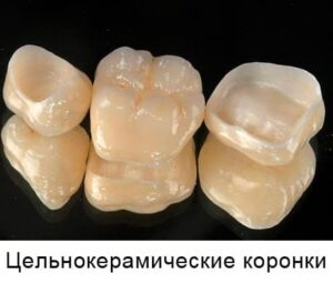 Безметалловая керамика на зубы недорого в СПб — стоматология «Премьера» ☎ +7 (812) 305-90-18