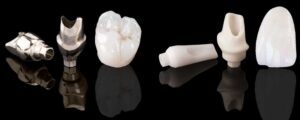 Зубные коронки на имплантатах под ключ в СПб недорого — «Премьера» ☎ +7 (812) 305-90-18