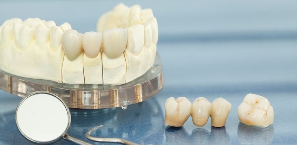 Недорогое несъемное протезирование зубов под ключ — стоматология «Премьера» ☎ +7 (812) 305-90-18 СПб