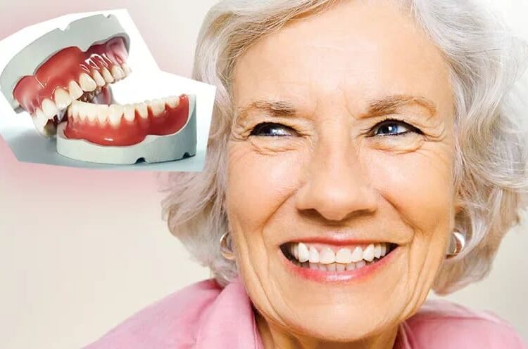 Зубные протезы при полной адентии под ключ недорого — стоматология «Премьера» ☎ +7 (812) 305-90-18