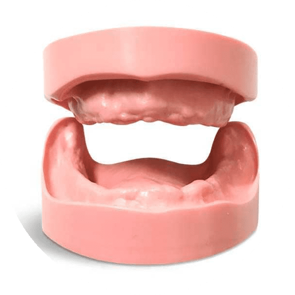 Протезирование при полной адентии — стоматология «Премьера» ☎ +7 (812) 305-90-18 СПб