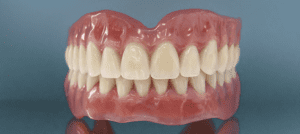 Акриловые протезы на передние зубы в СПб — стоматология «Премьера» ☎ +7 (812) 305-90-18