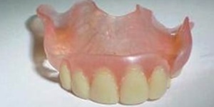 Протезы Acry-free на передние зубы в СПб — стоматология «Премьера» ☎ +7 (812) 305-90-18
