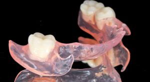 Протезы Acry-free на жевательные зубы в СПб — стоматология «Премьера» ☎ +7 (812) 305-90-18