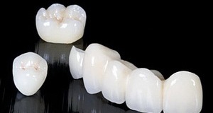 Протезирование жевательных зубов коронками — стоматология «Премьера» ☎ +7 (812) 305-90-18