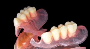 Акриловые протезы на жевательные зубы в СПб — стоматология «Премьера» ☎ +7 (812) 305-90-18