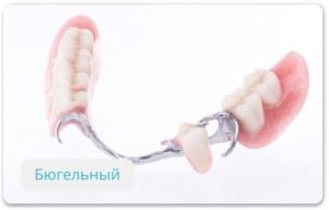 Бюгельные зубные протезы в СПб под ключ — стоматология «Премьера» ☎ +7 (812) 305-90-18