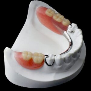 Частичный съемный зубной протез Полный съемный зубной протез — стоматология «Премьера» ☎ +7 (812) 305-90-18