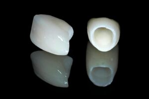 Керамические коронки для зубов в СПб недорого — стоматология «Премьера» ☎ +7 (812) 305-90-18