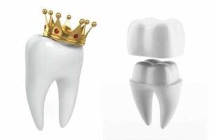Лечение и протезирование зубов в СПб — стоматология «Премьера» ☎ +7 (812) 305-90-18