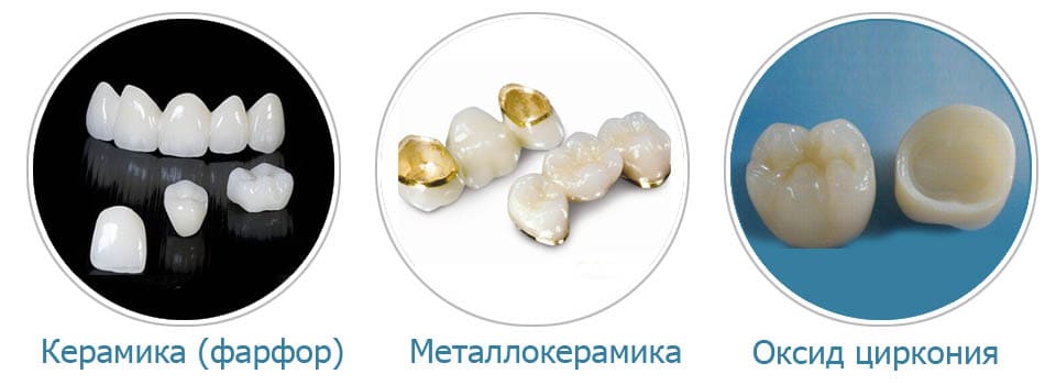 Протезирование зубов коронками в СПб недорого — стоматология «Премьера» ☎ +7 (812) 305-90-18